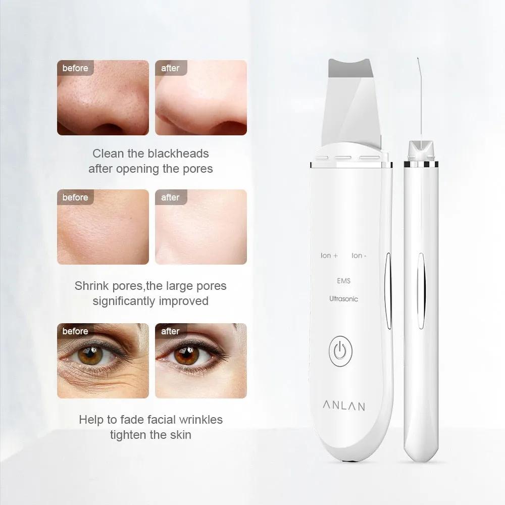 Ultrasonic Skin Cleaning Tool